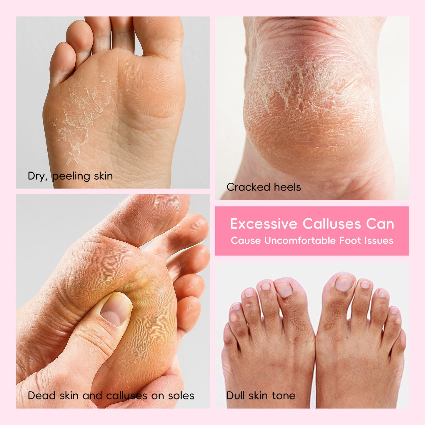LAIKOU Foot Peeling Mask - 1 Use Baby Feet